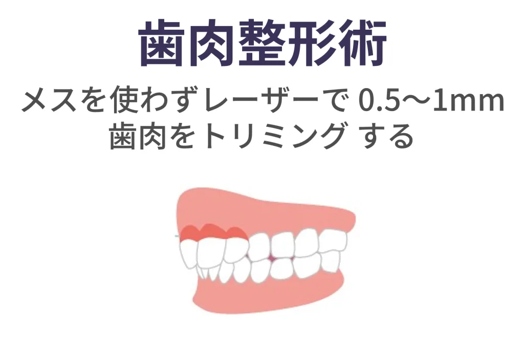 歯肉整形術