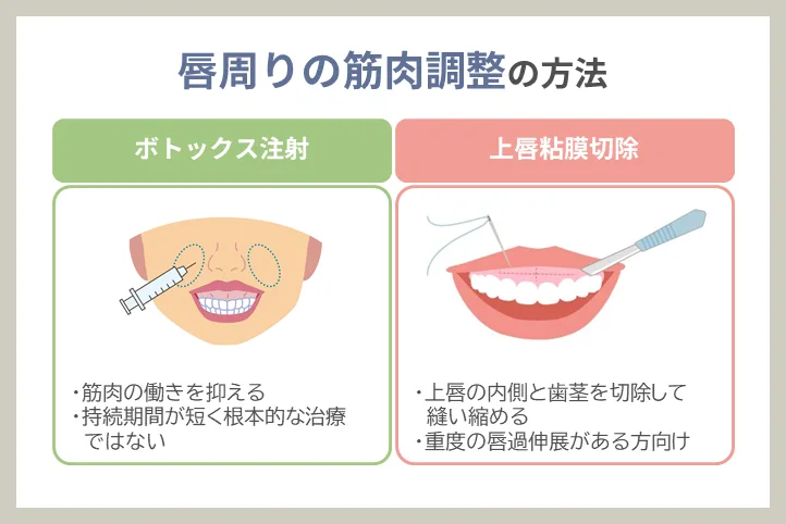 筋肉の調整（ボトックス注射・上唇粘膜切除術）