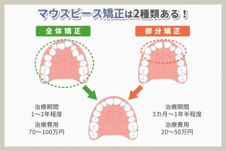 マウスピース矯正の種類│選び方を間違えた場合の事例を紹介