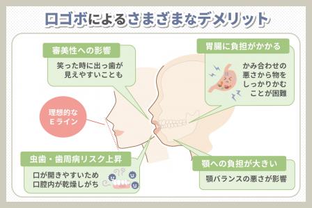 口ゴボを治療してキレイな横顔を手に入れよう！