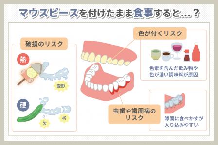 マウスピース矯正中の外食は大丈夫？気を付けるポイントを紹介