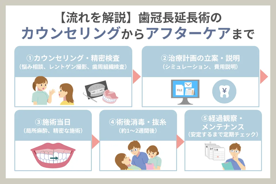 【流れを解説】歯冠長延長術のカウンセリングからアフターケアまで