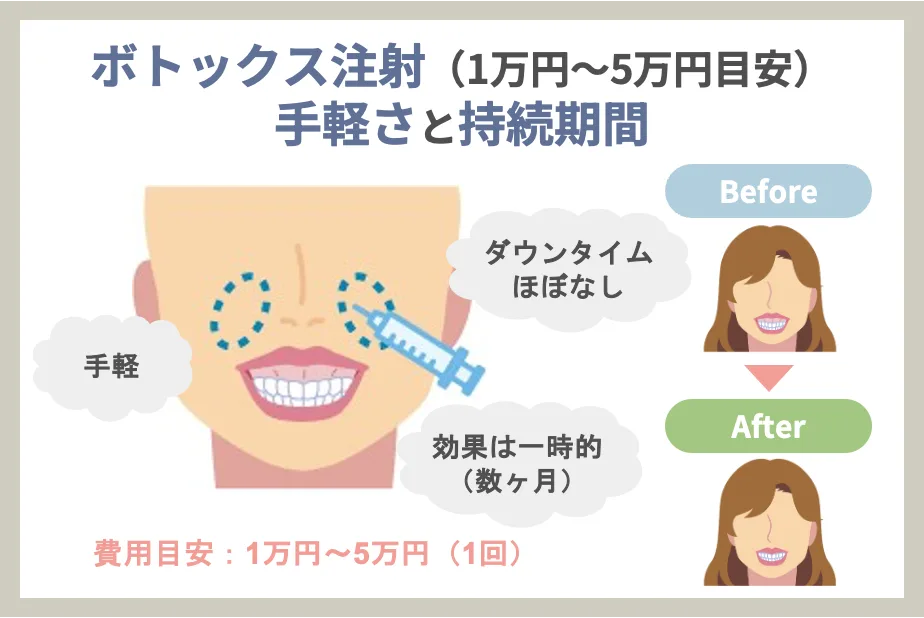 ボトックス注射（1万円～5万円目安） 手軽さと持続期間