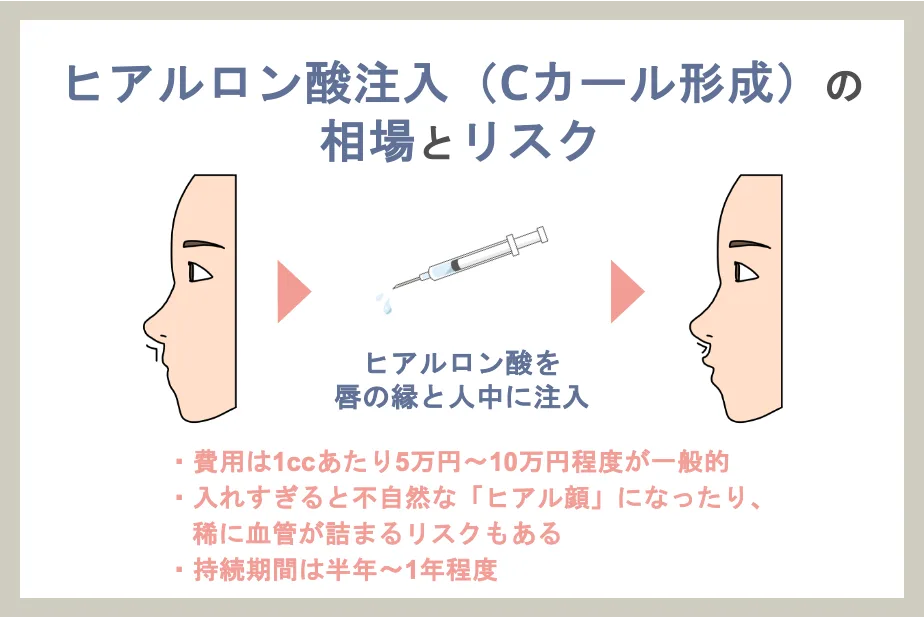 ヒアルロン酸注入（Cカール形成）の相場とリスク