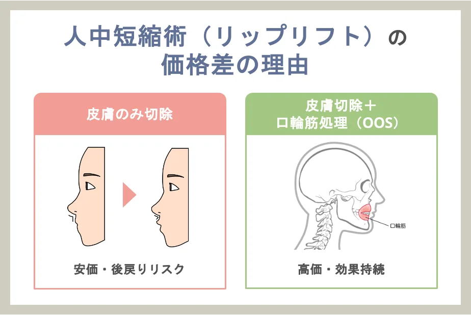 人中短縮術（リップリフト）の価格差の理由